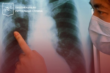 За последние 20 лет смертность от туберкулеза в России снизилась в шесть раз